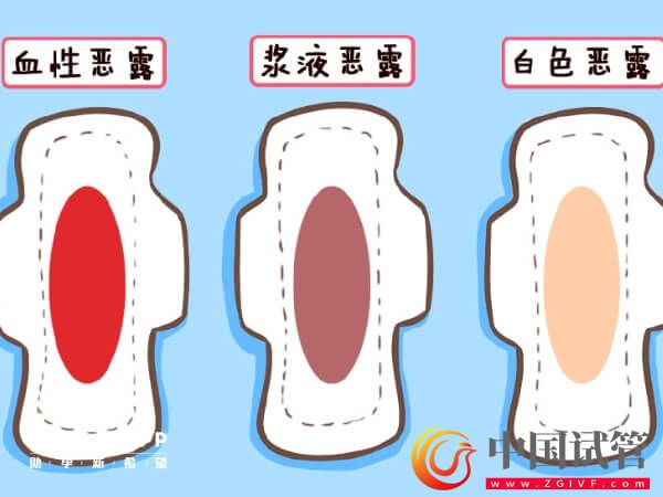 盤點產后惡露會有幾種顏色，出現黑色就需注意了！(圖1)