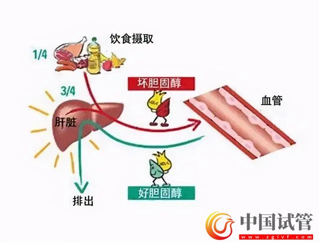 首款針對“壞膽固醇”的口服藥問世(圖1)
