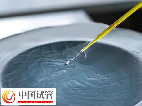 新鄉(xiāng)供卵試管嬰兒2個(gè)月就能完成，但這五個(gè)步驟可不能忽視(圖2)