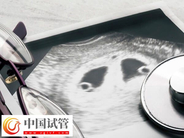 殘角子宮助孕選成都哪家醫院好？對比成功率選更放心(圖2)