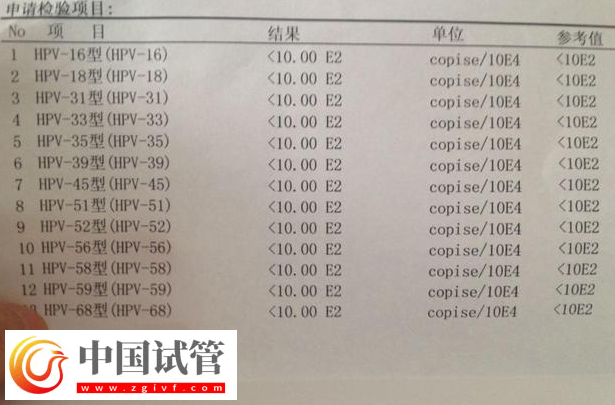 通過hpv報告單圖片怎么判斷自己是正常的呢？(圖1)