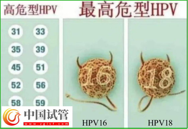 通過hpv報告單圖片怎么判斷自己是正常的呢？(圖3)