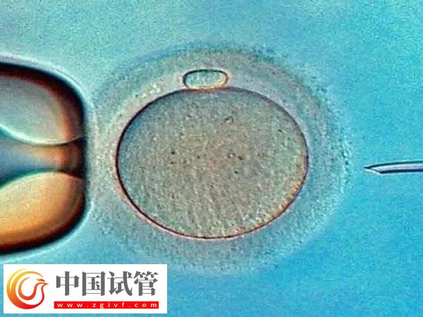 廣州市第一人民醫院試管嬰兒價格，養囊4千起(圖1)
