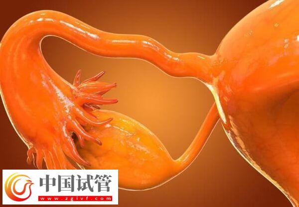 先天性卵巢發(fā)育不全可不可以做試管嬰兒(圖1)