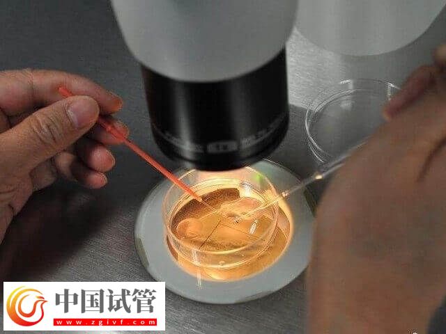 胚胎培養(yǎng)液對試管嬰兒有沒有影響(圖1)