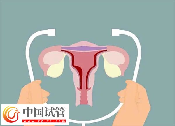 子宮內(nèi)膜薄做試管嬰兒能不能成功(圖1)