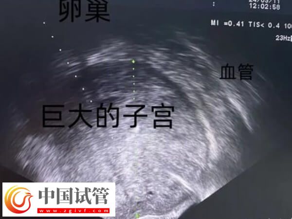 為什么41歲女人做試管嬰兒會失敗？背后真相大揭秘(圖2)