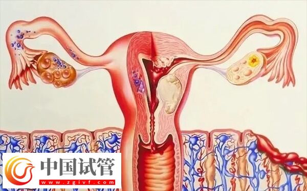 子宮內膜厚度多少做試管嬰兒才能成功著床？(圖3)