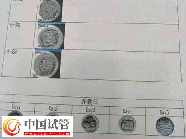 試管養囊成功的是否都是優胚(圖1)
