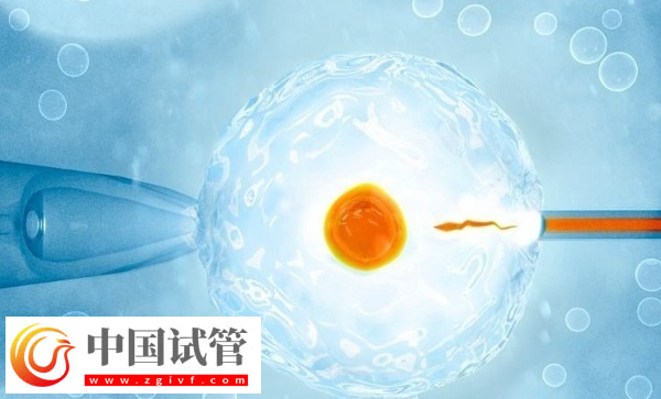 杭州醫(yī)保試管是否報銷(圖1)