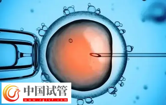深圳生殖中心最好的醫院：深圳市人民醫院排在榜首(圖3)