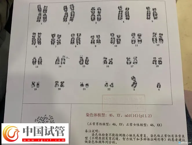 廣州做染色體檢查多少錢？廣東省婦幼保健院約230-3300元左右(圖2)