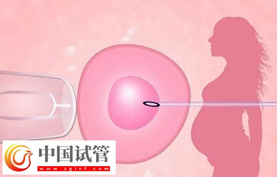 廣州哪家做試管嬰兒可以包懷上的？首選中山大學(xué)附屬第一醫(yī)院(圖3)