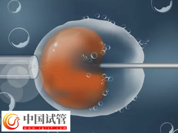 在義烏能不能做試管嬰兒(圖1)