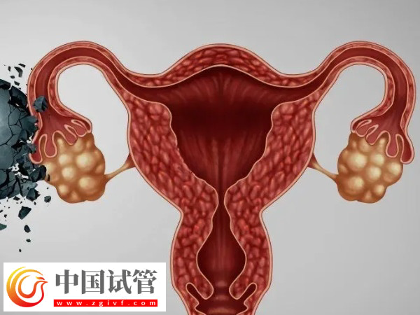 夫妻去美國做試管怎么選擇醫院(圖5)