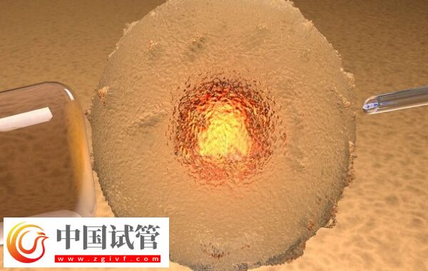 三代試管PGD技術(shù)檢測(cè)是否必須養(yǎng)囊(圖2)