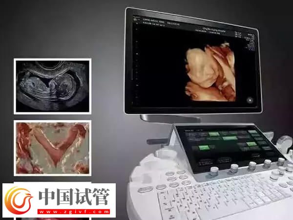 鷹潭公立三甲醫院做一次四維彩超多少錢？(圖1)