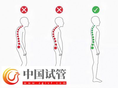 不良體態正悄悄損害你的健康(圖1)