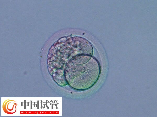 移植囊胚是不是容易生下雙胞胎(圖2)
