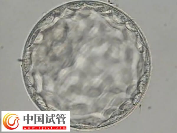 胚胎8細胞三級是不是比5細胞好(圖2)