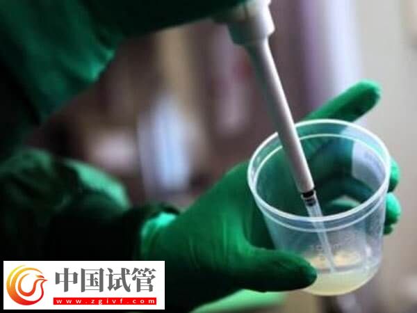 艾滋病洗精費用是多少(圖2)
