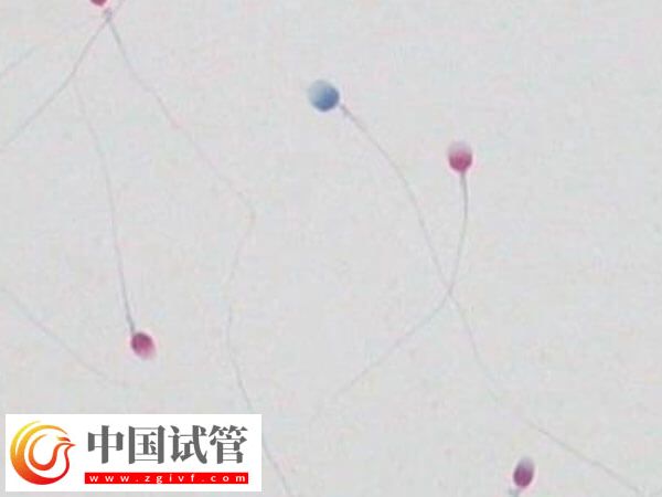 精子碎片報告是什么樣的(圖1)