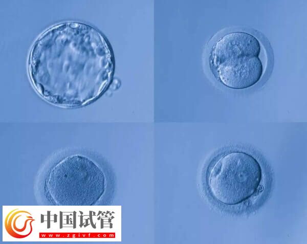 高齡是不是適合養囊胚(圖1)