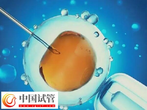 北京和上海做試管哪個技術(shù)好(圖1)
