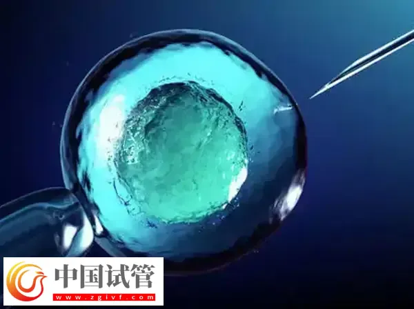 北京和上海做試管哪個技術(shù)好(圖2)