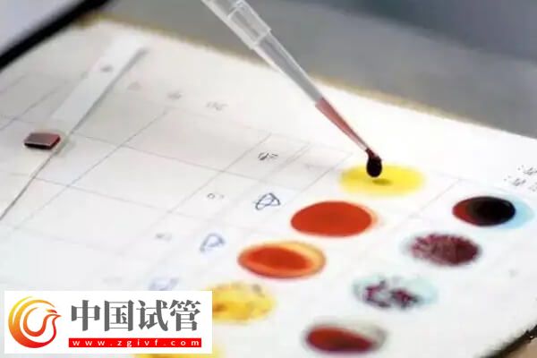 關(guān)節(jié)攣縮做試管有沒有影響(圖2)