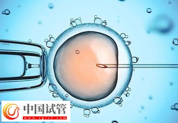 長沙開展輔助生殖技術醫院中助孕成功率高的有哪些？(圖2)