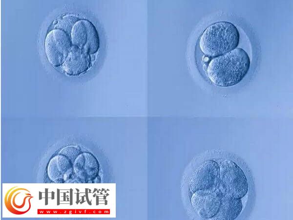 4aa的囊胚是什么級(jí)別?是最好的胚胎嗎?(圖1) 4aa的囊胚是什么級(jí)別?是最好的胚胎嗎?(圖1)