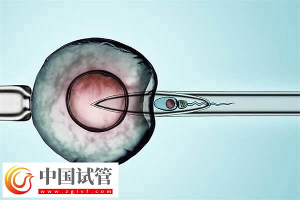 試管嬰兒改良長方案促排卵有哪些優缺點？(圖1)