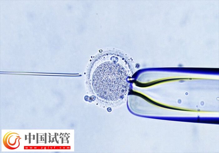 試管嬰兒助孕有幾個階段(圖1) 試管嬰兒助孕有幾個階段(圖1)