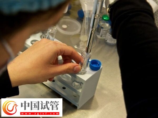 取完卵后如何判定腹水(圖1)